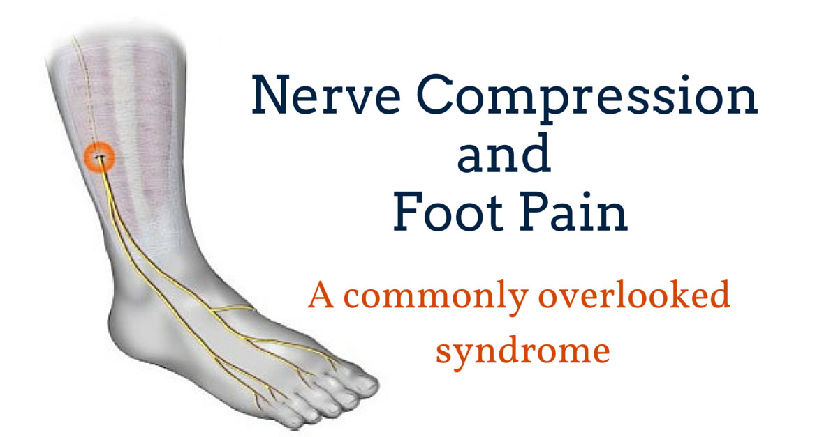 Foot Pain Due to A Nerve Entrapment