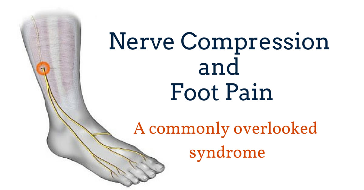 Foot Pain Due to A Nerve Entrapment - Gray Chiropractic St.Catharines