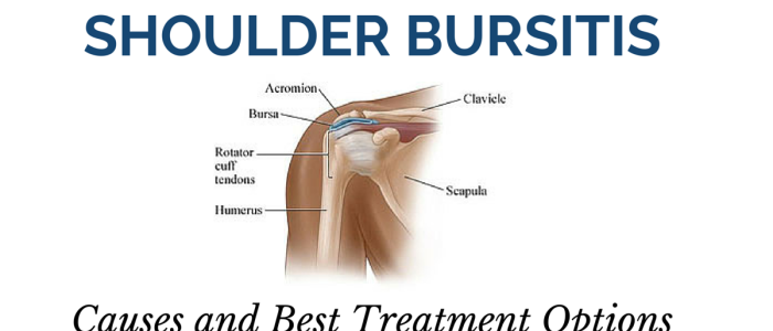 Treating Shoulder Bursitis Niagara Shoulder Pain Clinic