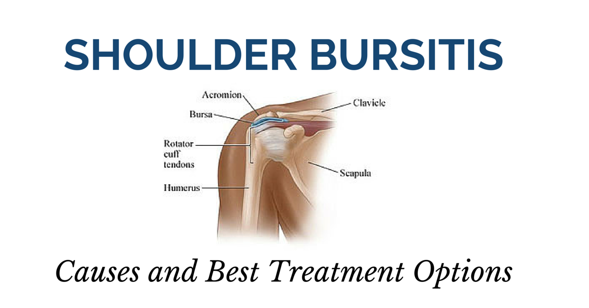Shoulder Bursitis Causes and Best Treatment Options