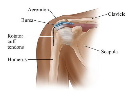 shoulder-bursitis