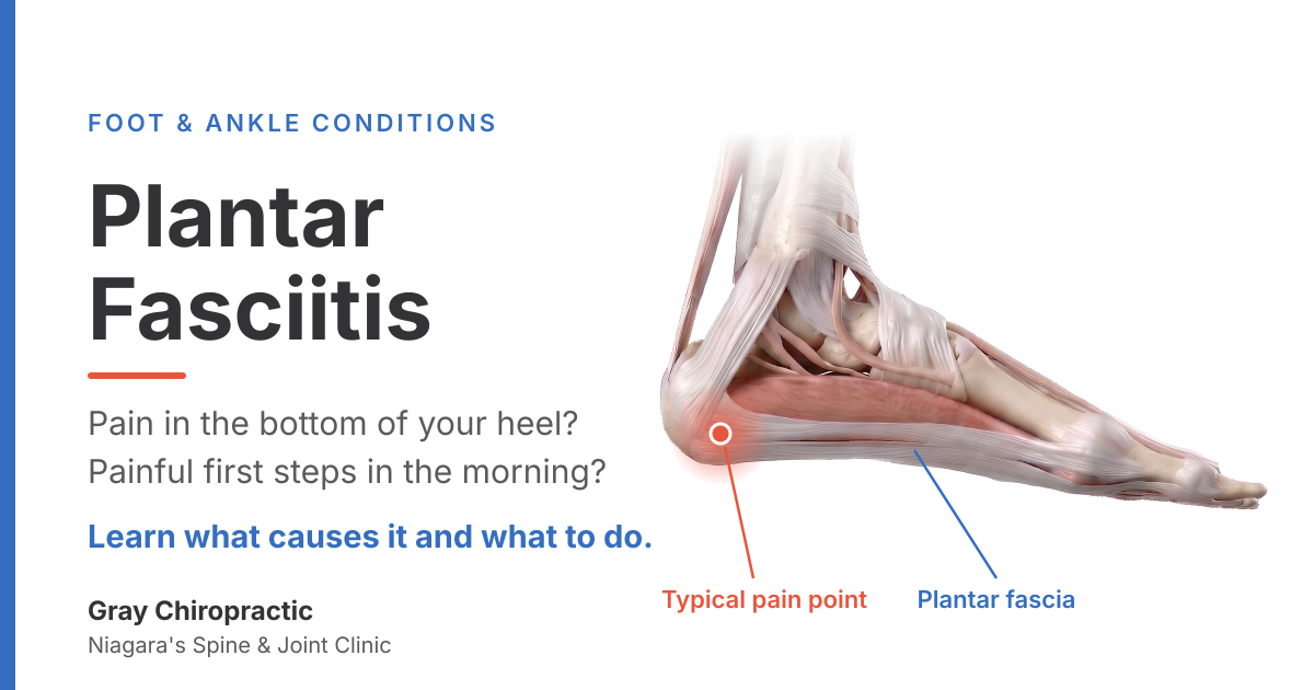 Plantar fasciitis: heel pain with your first steps