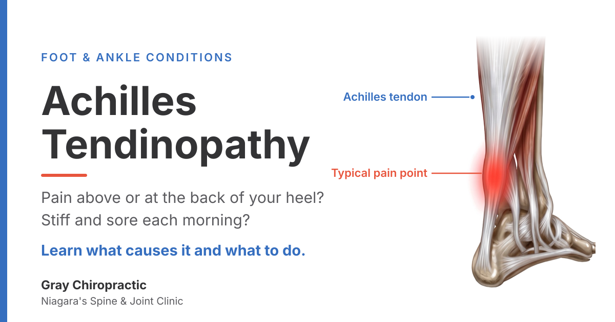 Achilles tendinopathy: heel and lower calf pain