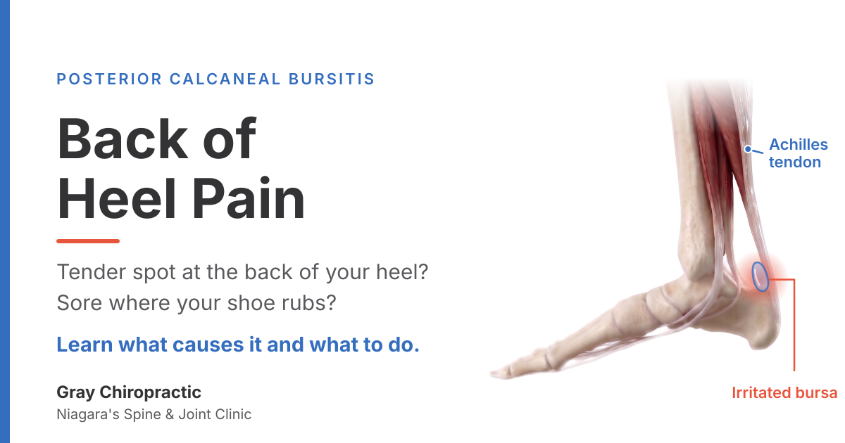 Posterior calcaneal bursitis: pain at the back of the heel