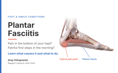Heel Pain With Your First Steps: Understanding Plantar Fasciitis