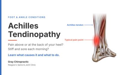 Achilles Tendinopathy: Why Your Heel and Lower Calf Pain Won’t Go Away