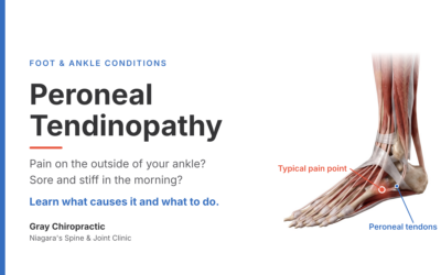 Peroneal Tendinopathy: Why Your Outer Foot Pain Keeps Coming Back
